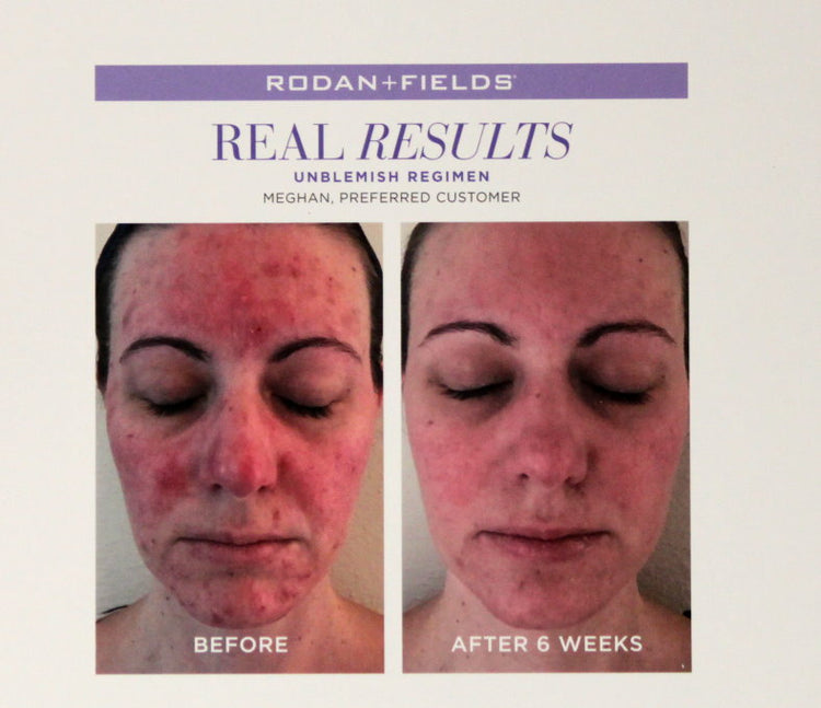 Rodan & Fields Give It A Glow Sample Pack